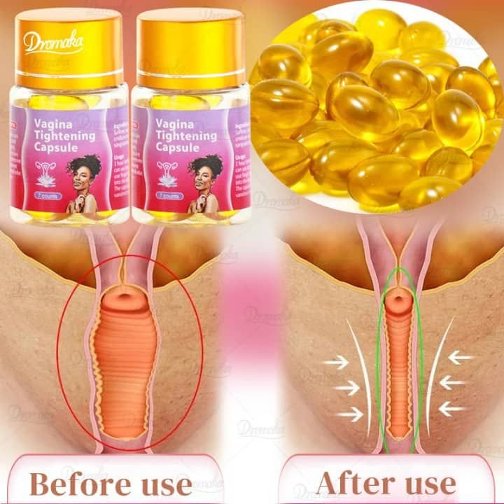 Dromaka Herbal Vagina Tightening Softgel Capsules (2-Pack / 14 Softgels)